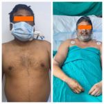 सर गंगाराम अस्पताल में दिल्ली का पहला सफल द्विपक्षीय हाथ प्रत्यारोपण…